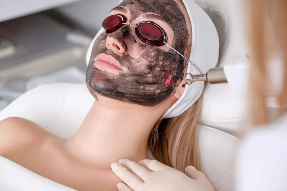 China Doll Facial (Carbon Peel)